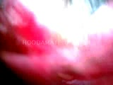 Thumb 14