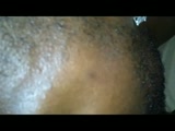 Thumb 17